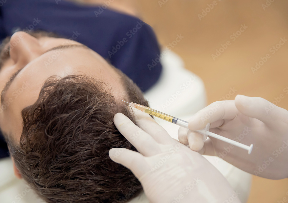 PRP-medicinska-terapija_1